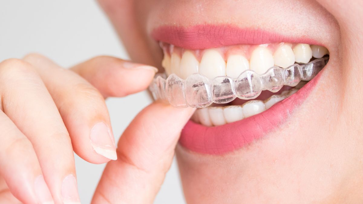A evolução do aparelho dental: De capacete à tênue invisibilidade