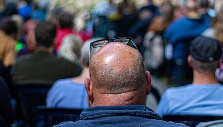 Pessoa careca