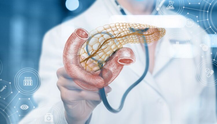 Atenção para o sintoma silencioso do câncer de pâncreas - Imagem: arquivo/Canva/Edição Notíciadamanhã.com.br.