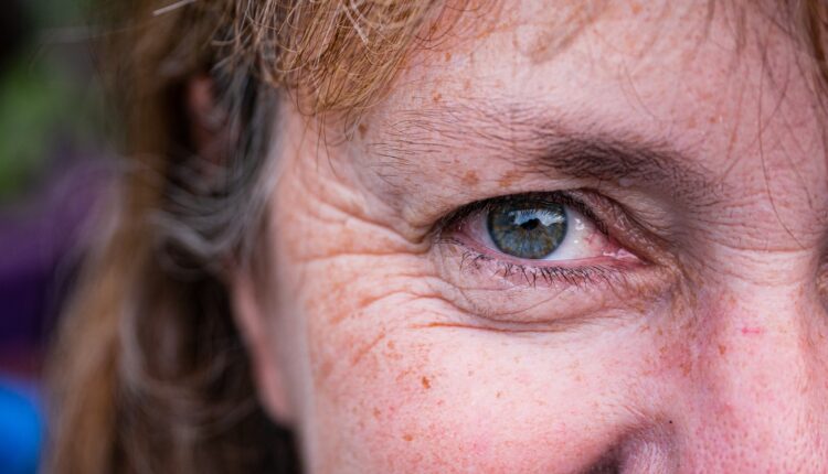 RUGAS NUNCA MAIS! 3 receitas de BOTOX caseiro com maisena