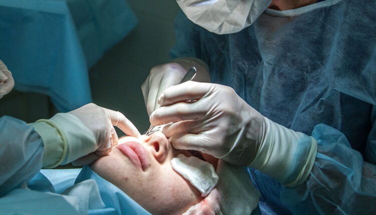 Plásticas pelo SUS: veja quais cirurgias você pode fazer de graça