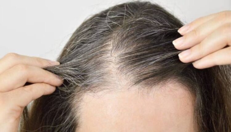 A preocupação com a presença de um eventual cabelo grisalho está aumentando entre as mulheres. Os sinais de envelhecimento afetam a beleza, e o cabelo grisalho é uma marca característica da longevidade. Se você deseja se livrar deles, especialistas recomendam opções naturais, encontradas principalmente em algumas flores. Aprenda, logo abaixo, a receita milagrosa que vai dar um ar mais jovial ao seu cabelo