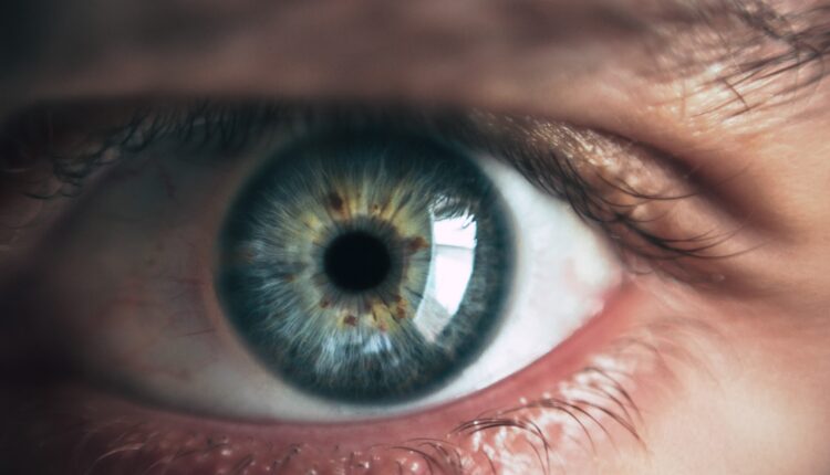 Recentemente, começou a circular nas redes sociais, um vídeo onde um homem passa por uma cirurgia para mudar a cor dos olhos. A postagem viralizou e já ultrapassou 5 milhões de visualizações. Entretanto, especialistas estão preocupados com o eventual interesse de mais pessoas em realizar o procedimento que é extremamente perigoso e possui graves riscos para quem se submente à cirurgia. Saiba mais detalhes sobre a história, logo abaixo.