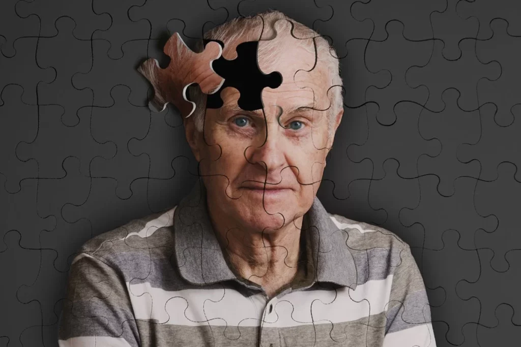 O Alzheimer, uma doença que afeta milhões de pessoas em todo o mundo, ainda não tem cura. (Foto divulgação)