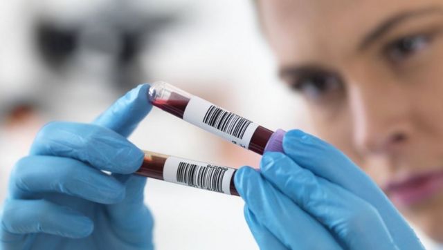 Este exame de sangue inovador consegue determinar a idade real de onze órgãos importantes (Foto divulgação)