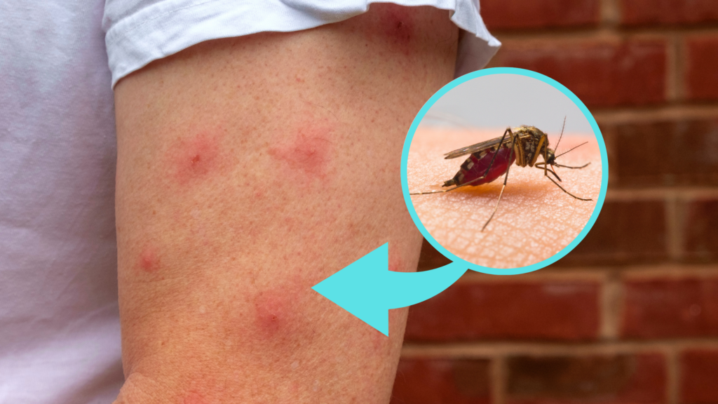 Repelente natural contra os borrachudos em casa ou na praia