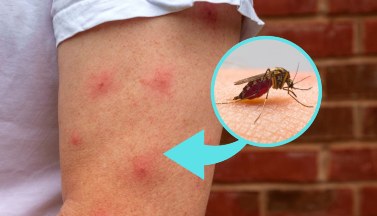 Aprenda o que fazer para se livrar das picadas de borrachudo em casa, na praia ou em qualquer lugar que vá durante o ano.