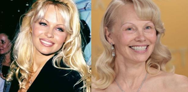Pamela Anderson nos anos 1990; ao lado, em 2025