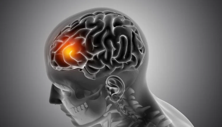 O que causa a meningite tipo C?